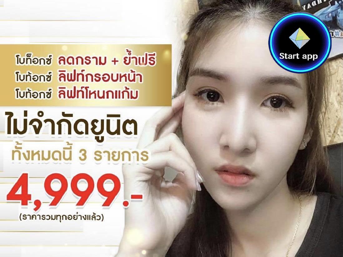 ลดกราม + ลิฟหน้า + ลิฟโหนก